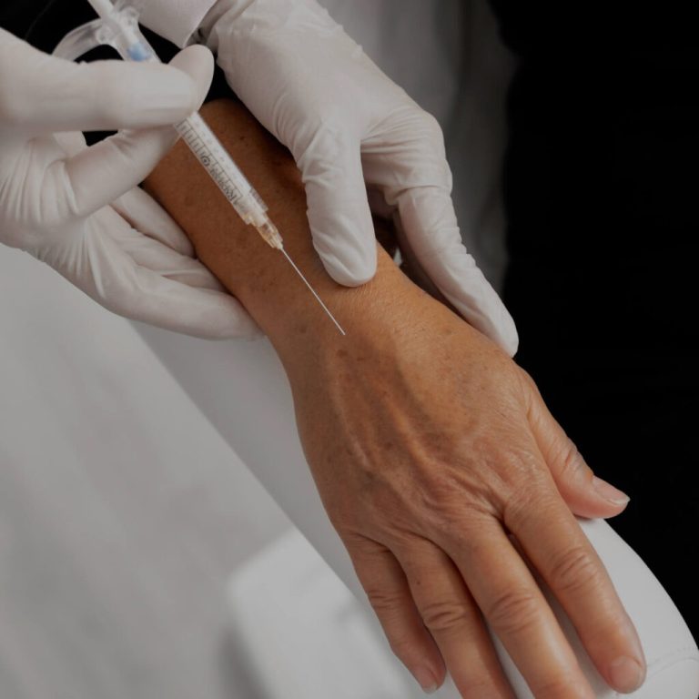 Hand Rejuvenation from Medical Aesthetics BY Lacey
